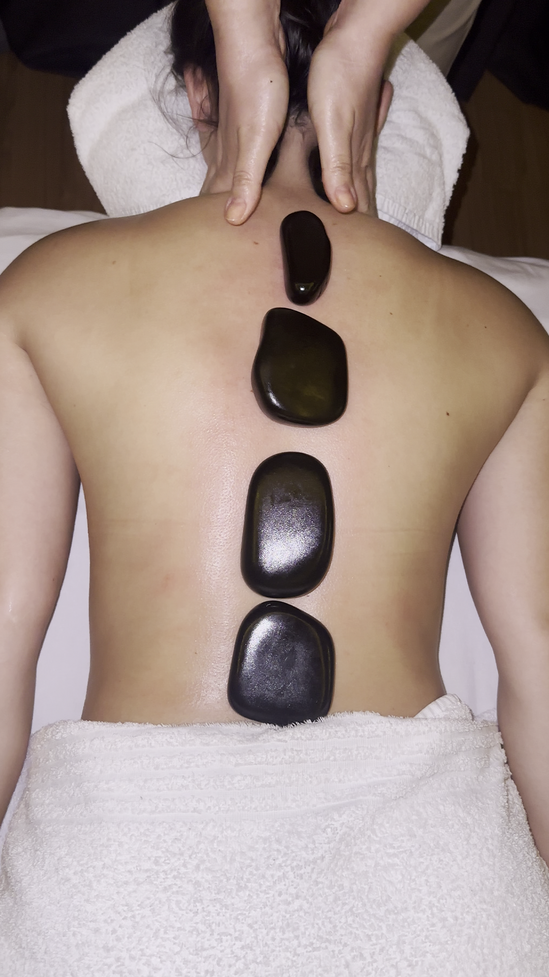 Fibromialgia